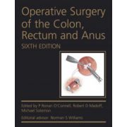 Operative Surgery of the Colon, Rectum and Anus