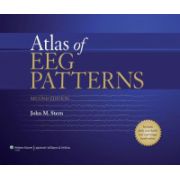 Atlas of EEG Patterns