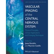 Vascular Imaging of the Central Nervous System: Physical Principles, Clinical Applications and Emerging Techniques