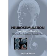 Neurostimulation: Principles and Practice