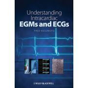 Understanding Intracardiac EGMs and ECGs