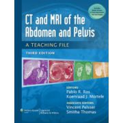 CT & MRI of the Abdomen and Pelvis: A Teaching File