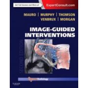 Image-Guided Interventions (Expert Radiology Series)