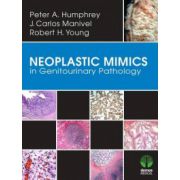 Neoplastic Mimics in Genitourinary Pathology