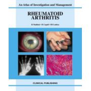 Rheumatoid Arthritis: An Atlas of Investigation and Management