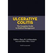Ulcerative Colitis: Complete Guide to Medical Management