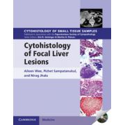 Cytohistology of Focal Liver Lesions (Cytohistology of Small Tissue Samples)