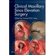 Clinical Maxillary Sinus Elevation Surgery