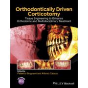 Orthodontically Driven Corticotomy: Tissue Engineering to Enhance Orthodontic and Multidisciplinary Treatment