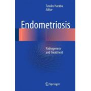 Endometriosis: Pathogenesis and Treatment