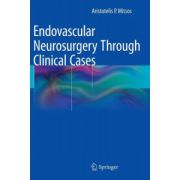Endovascular Neurosurgery Through Clinical Cases