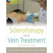 Sclerotherapy and Vein Treatment (with DVD)