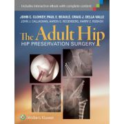 Adult Hip: Hip Preservation Surgery