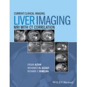 Liver Imaging: MRI with CT Correlation