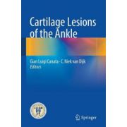 Cartilage Lesions of the Ankle
