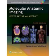 Molecular Anatomic Imaging: PET/CT, PET/MR and SPECT CT