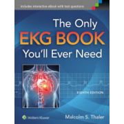 Only EKG Book You'll Ever Need