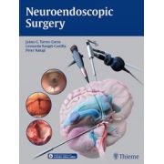 Neuroendoscopic Surgery