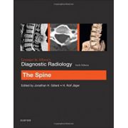 Grainger & Allison's Diagnostic Radiology: Spine