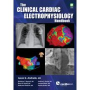 Clinical Cardiac Electrophysiology Handbook