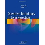 Operative Techniques in Liver Resection
