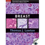 Breast (Cambridge Illustrated Surgical Pathology)
