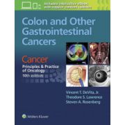 Colon and Other Gastrointestinal Cancers: Cancer: Principles & Practice of Oncology