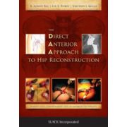 Direct Anterior Approach to Hip Reconstruction