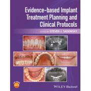 Evidence-based Implant Treatment Planning and Clinical Protocols