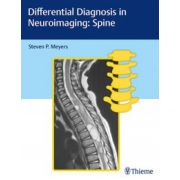 Differential Diagnosis in Neuroimaging: Spine
