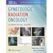 Gynecologic Radiation Oncology: A Practical Guide