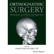 Orthognathic Surgery: Principles, Planning and Practice