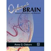 Osborn's Brain