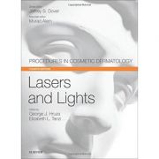 Lasers and Lights: Procedures in Cosmetic Dermatology Series