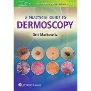 Practical Guide to Dermoscopy