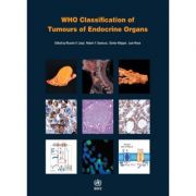 WHO Classification of Tumours of Endocrine Organs (WHO Classification of Tumours, Volume 10)