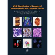 WHO Classification of Tumours of Haematopoietic and Lymphoid Tissues (WHO Classification of Tumours, Volume 2)