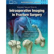 Illustrated Tips and Tricks for Intraoperative Imaging in Fracture Surgery