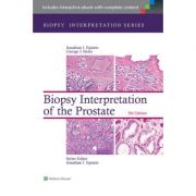 Biopsy Interpretation of the Prostate