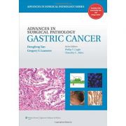Advances in Surgical Pathology: Gastric Cancer