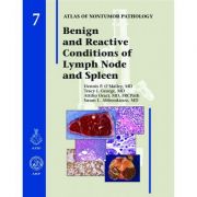 Benign and Reactive Conditions of Lymph Node and Spleen (AFIP Atlas of Non-Tumor Pathology, Series 1, Number 7)