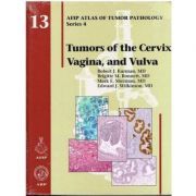 Tumors of the Cervix Vagina and Vulva (AFIP Atlas of Tumor Pathology, Series 4, Number 13)