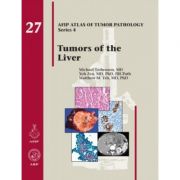 Tumors of the Liver (AFIP Atlas of Tumor Pathology, Series 4, Number 27)