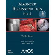Advanced Reconstruction: Hip 2