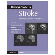 More Case Studies in Stroke: Common and Uncommon Presentations
