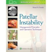 Patellar Instability: Management Principles and Operative Techniques