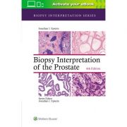 Biopsy Interpretation of the Prostate (Biopsy Interpretation Series)