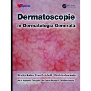 Dermatoscopie în Dermatologia Generală