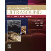 Musculoskeletal Ultrasound (How, Why and When)