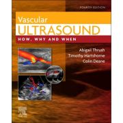 Vascular Ultrasound: How, Why and When